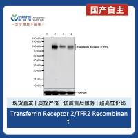 Transferrin Receptor 2/TFR2 Recombinant Rabbit mAb (S-1735-133)
