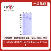 E-Selectin/CD62E His Tag Protein, Cynomolgus