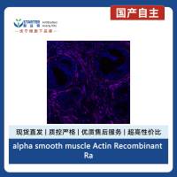 alpha smooth muscle Actin Recombinant Rabbit mAb (Alexa Fluor® 700 Conjugate) (S-132-63)