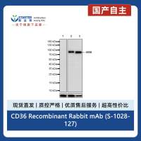 CD36 Recombinant Rabbit mAb (S-1028-127)