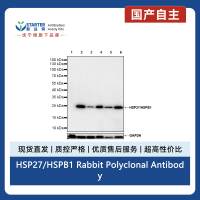 HSP27/HSPB1 Rabbit Polyclonal Antibody