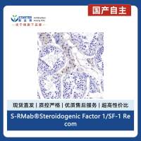 S-RMab®Steroidogenic Factor 1/SF-1 Recombinant Rabbit mAb (SDT-1666-11)