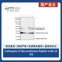 Cathepsin D Recombinant Rabbit mAb (S-R345)