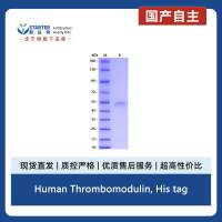Human Thrombomodulin, His tag