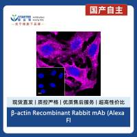 β-actin Recombinant Rabbit mAb (Alexa Fluor® 647 Conjugate) (SDT-R015)
