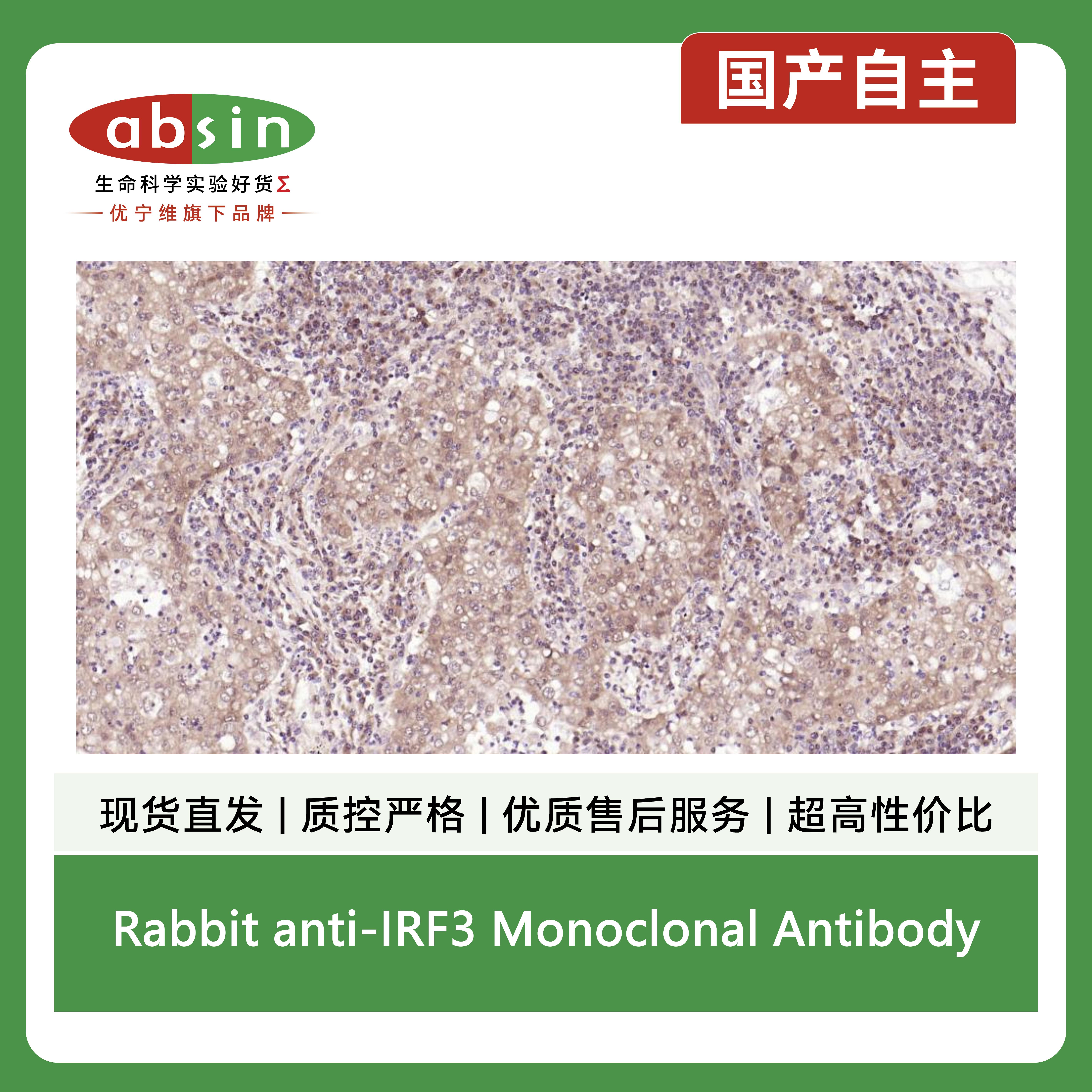 Rabbit anti-IRF3 Monoclonal Antibody产品图