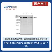 VPS18 Recombinant Rabbit mAb (S-2517-69)