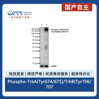 Phospho-TrkA(Tyr674/675)/TrkB(Tyr706/707) Recombinant Rabbit mAb (S-3359)