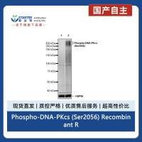 Phospho-DNA-PKcs (Ser2056) Recombinant Rabbit mAb (S-3813)