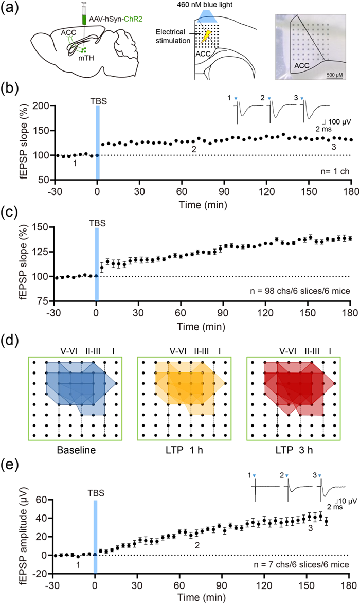 MED64平面微电极矩阵记录系统文章分享,福建医大发表在Molecular Pain “Biphasic synaptic plasticity of the medial thalamic-cingulate pathway contributes to pain hypersensitivity in vivo”