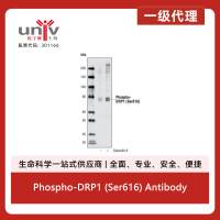 Phospho-DRP1 (Ser616) Antibody