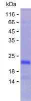 Recombinant Human NOB1 Protein(C-His)