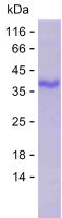 Recombinant Human ZBTB5 Protein(C-His)
