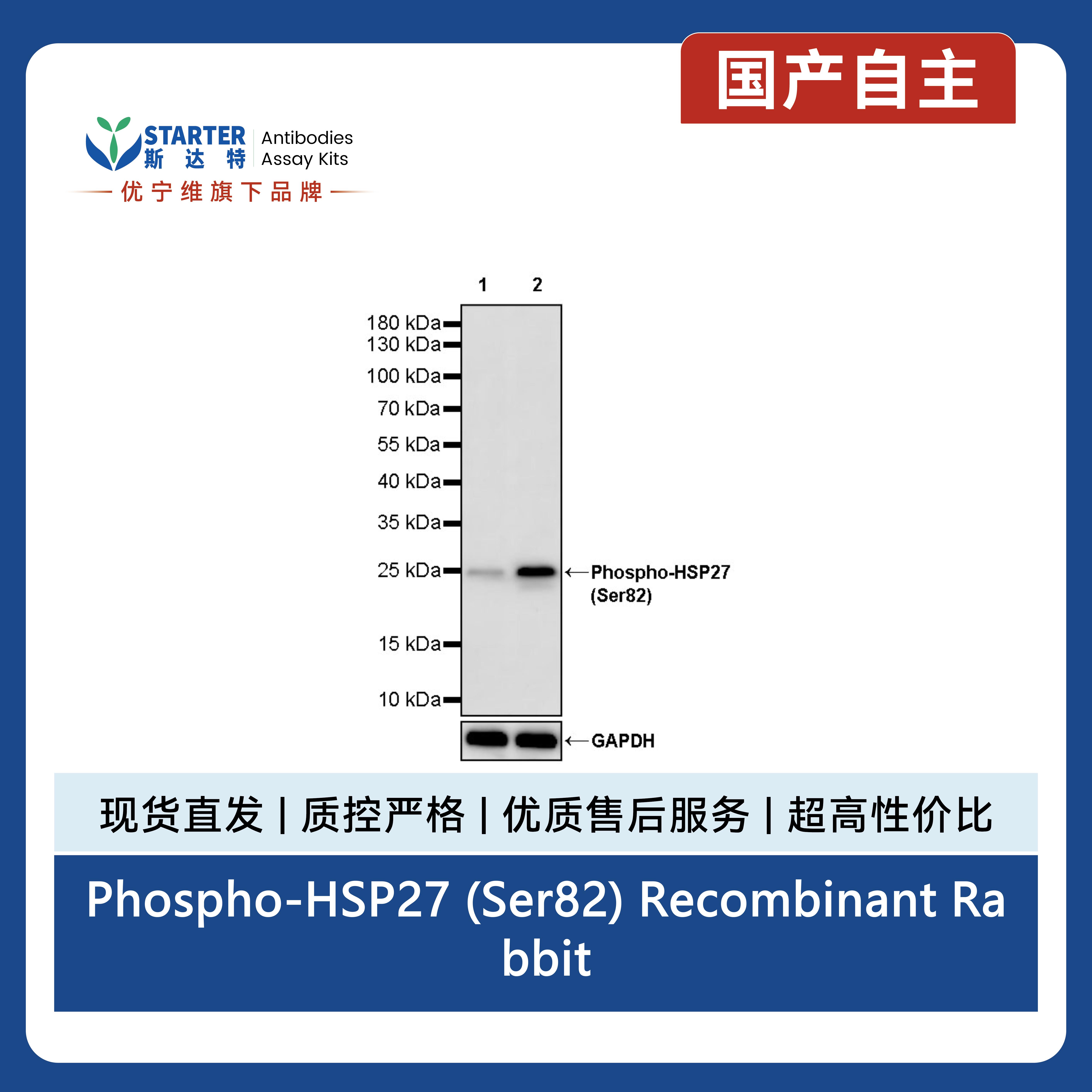 Phospho-HSP27 (Ser82) Recombinant Rabbit mAb (S-4792)产品图