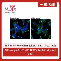 NF-kappaB p65 (D14E12) Rabbit Monoclonal Antibody (Alexa Fluor® 647 Conjugate)