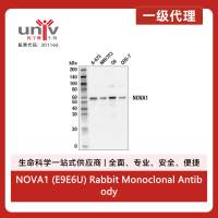 NOVA1 (E9E6U) Rabbit Monoclonal Antibody