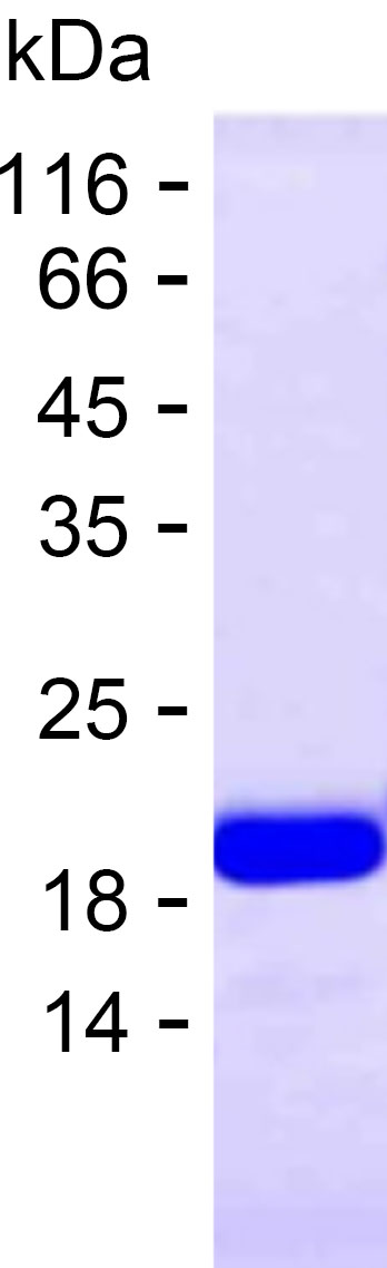 Recombinant Human CAPNS1 Protein(C-His)产品图