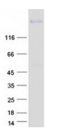 Recombinant Human PLXNC1 Protein(C-MyC & Flag)