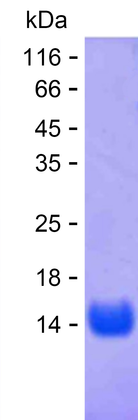 Recombinant Human RNF25 Protein(C-His)产品图