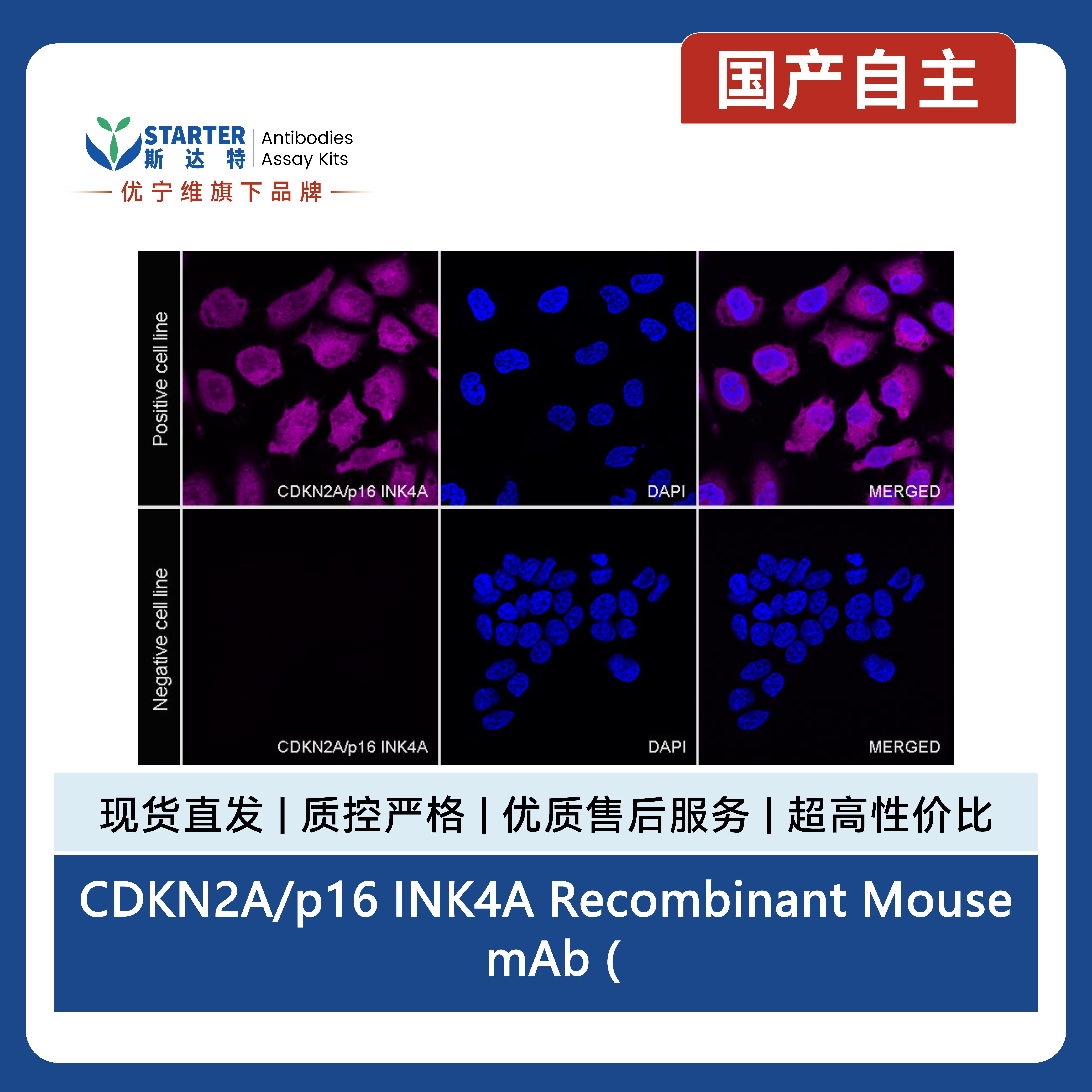 CDKN2A/p16 INK4A Recombinant Mouse mAb (Alexa Fluor® 647 Conjugate) (SDT-4675)产品图