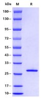 Recombinant Schistosoma Japonicum GST Protein(E Tag)