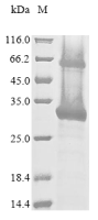 Recombinant Human M6PR Protein (N-terminal 10xHis)