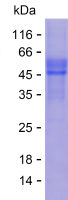 Recombinant Human FXYD5 Protein(C-hFc & C-His)