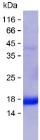 Recombinant Human KBTBD4 Protein(C-His)