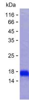 Recombinant Human TERB1 Protein(C-His)