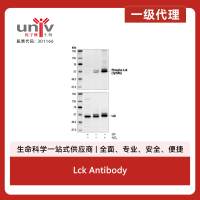 Lck Antibody