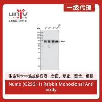 Numb (C29G11) Rabbit Monoclonal Antibody