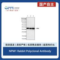 NPM1 Rabbit Polyclonal Antibody