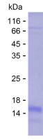 Recombinant Human ZXDA Protein(C-His)