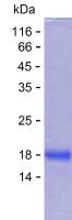 Recombinant Human UQCC2 Protein(C-His)
