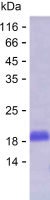 Recombinant Human SLC1A4 Protein(C-His)
