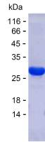 Recombinant Human SYCE1L Protein(C-His)
