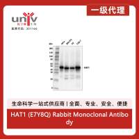 HAT1 (E7Y8Q) Rabbit Monoclonal Antibody