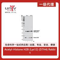 Acetyl-Histone H2B (Lys12) (D7H4) Rabbit Monoclonal Antibody