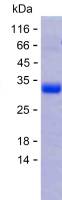 Recombinant Human ARSA Protein(C-His)