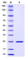 Recombinant HIV(HIV1-HXB2) P24 Protein(C-His Tag)