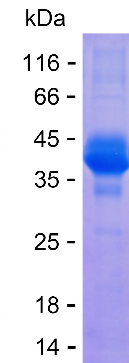 Recombinant Human PTH1R Protein(C-hFc & C-His)产品图