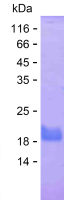 Recombinant Human GPR84 Protein(C-His)