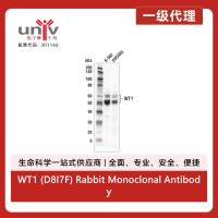 WT1 (D8I7F) Rabbit Monoclonal Antibody