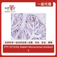 PYY (D1K3Q) Rabbit Monoclonal Antibody