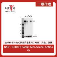 NSD1 (E2U6H) Rabbit Monoclonal Antibody
