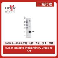 Human Reactive Inflammatory Cytokine Antibody Sampler Kit