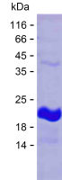 Recombinant Human CDK11A Protein(C-His)