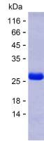 Recombinant Human TMEM161B Protein(N-mSUMO & C-His)