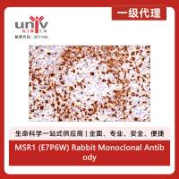 MSR1 (E7P6W) Rabbit Monoclonal Antibody