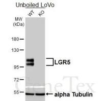 LGR5 antibody [HL4443]